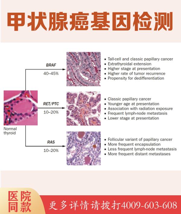 脊肌萎缩症及鉴别诊断相关疾病检测