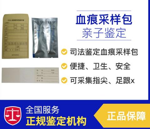 河北张家口头发亲子鉴定准确率